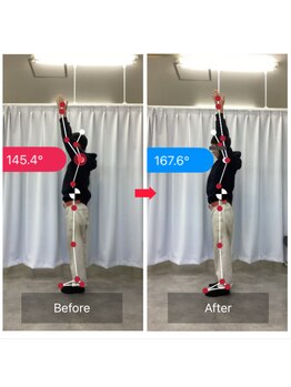 ナオル整体 山形院(NAORU整体)/Before→After【20代/男性】