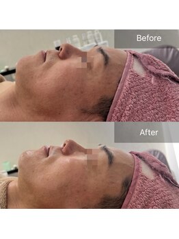 ビアラ(VIALA)/一度で分かる、整った横顔