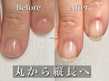 リリー/丸から縦長の爪へ