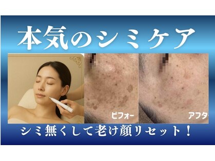 ルナ(Luna)の写真