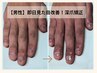 【男性/深爪】長さを出す深爪矯正初回体験￥34100→