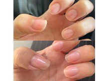 ニマ(nima)の雰囲気（ジェルネイルでペラペラになった爪も潤った弾力ある自爪に育成）