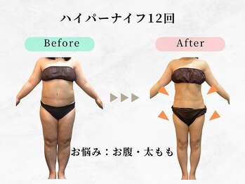 ウェリナ平和堂長久手院/小顔矯正/骨盤矯正/痩身/整体