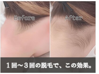 エムローズ(M.rose)の写真