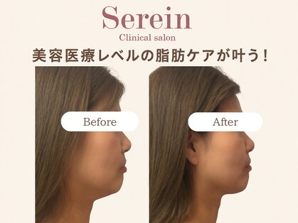 スレーン 上本町(Serein)の写真
