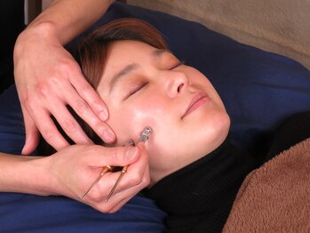 セプトきらく鍼灸整体院(Sept.)/小顔・美顔調整