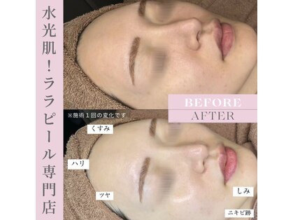 シェリエ(Sheller)の写真