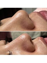 エステサロン ジョアアンジェ(joie ange)/驚きの結果に感動！