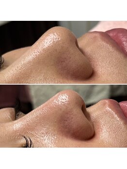 エステサロン ジョアアンジェ(joie ange)/驚きの結果に感動!