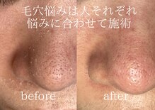 ピアレス(Peerless)