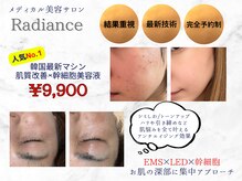 レディアンス