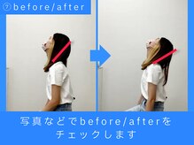 ケアフルはりきゅう施術院/before & after