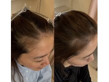 リベルテ(Liberte)/プロセル頭皮トリートメント