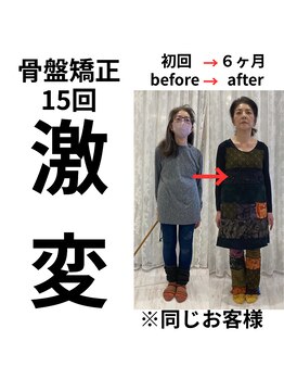 ケートータルビューティー(K. total beauty)/骨盤矯正15回、激変！（正面）