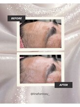 ラインファンタジー 武庫之荘店/どの年齢層も◎エイジングケア