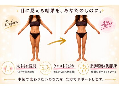 ソエルテ(soerute)の写真