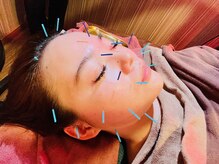 漢方アロマサロン 大森/ショート美容鍼