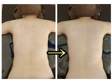 ラフ(laugh)/背中リンパマッサージ