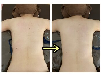 ラフ(laugh)/背中リンパマッサージ