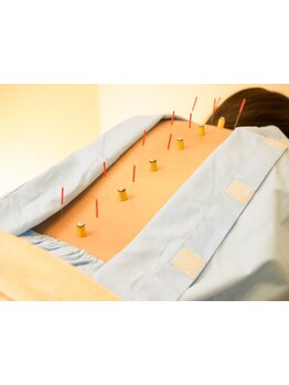 首・肩のつらさを改善したい