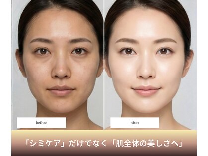 シアラ(SHIARA)の写真