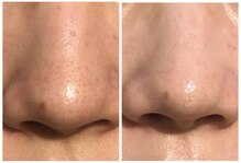 リノレア(Lino_Lea)