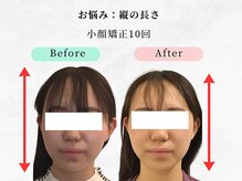 ウェリナ平和堂長久手院/小顔矯正/骨盤矯正/痩身/整体