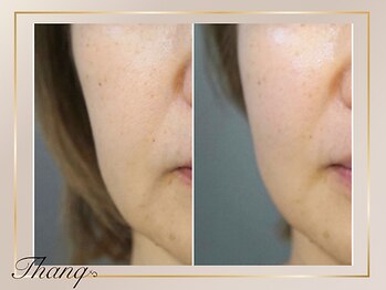 サンク(Thanq)の写真/肌の内側からハリツヤ溢れる水光肌になりたい方へ！滑らかなノーファンデ素肌で美肌管理をサポート◎