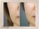 サンク(Thanq)の写真/肌の内側からハリツヤ溢れる水光肌になりたい方へ！滑らかなノーファンデ素肌で美肌管理をサポート◎