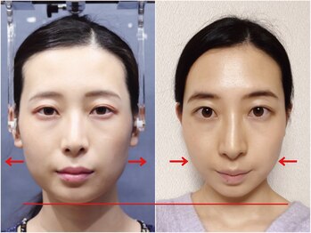 さつま骨格矯正 渋谷 恵比寿本院/歪み小顔矯正＋骨盤矯正