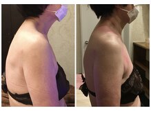 アンベリールプラス(embellir+)/長年蓄積された肩こり