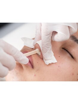 デリケート部分の脱毛/Vライン/VIO