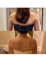 ディア スプリーマ/ブライダルエステ★美白効果も!