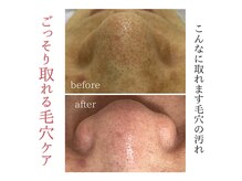 ヒペリカムリリー(hypericum_lily)の雰囲気（本気の肌改善行っております。あなたもノーファンデーションに。）