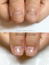 マリーロール 淀屋橋本店(Marie Laure)/自爪育成/深爪矯正/ネイルケア