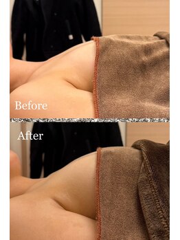 プリマベラ 大阪梅田(primabella)/一回の施術でふわふわバストへ！