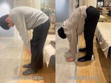 グレフル鍼灸接骨院 整体院 心斎橋/ヘル二ア／腰痛／神経-痛