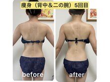 アーチ(AR-CH.)/痩せたい部分を集中施術～上半身