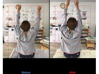 ストレチックス 近江八幡店/BeforeAfter