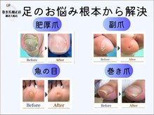 巻き爪補正店 鎌倉大船店