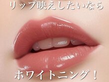 ホワイトニングサロン ホワイト(WHITE)/セルフホワイトニング/大阪/福島