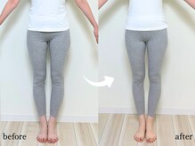 エーアール(AR)/【Before/After】