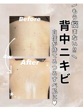 ビレボ マエバシ(BEREVO maebashi)/Before After