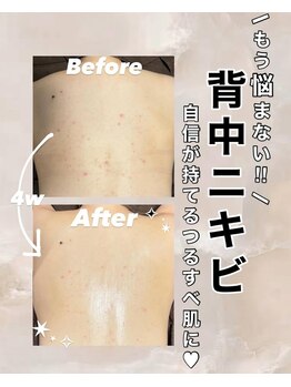 ビレボ マエバシ(BEREVO maebashi)/Before After