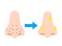 アイシェリー(eyecherie)/毛穴エクストラクション