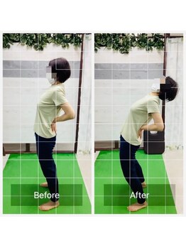 門前仲町イエティ鍼灸整骨院（旧：イエティ鍼灸整骨院）/ビフォーアフター♪