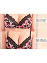 フェリーチェ 福山店(FALICE)/before＆afterバストアップ症例