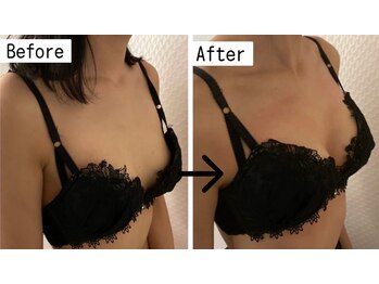 プレフィール(PLEAFEEL)/