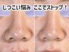 【毛穴改善】“毛穴の黒ずみ”サヨナラ！毛穴洗浄＋ビタミンコース90分¥6,800