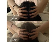 ハートランド(HEARTLAND)/ひたいボトする前に